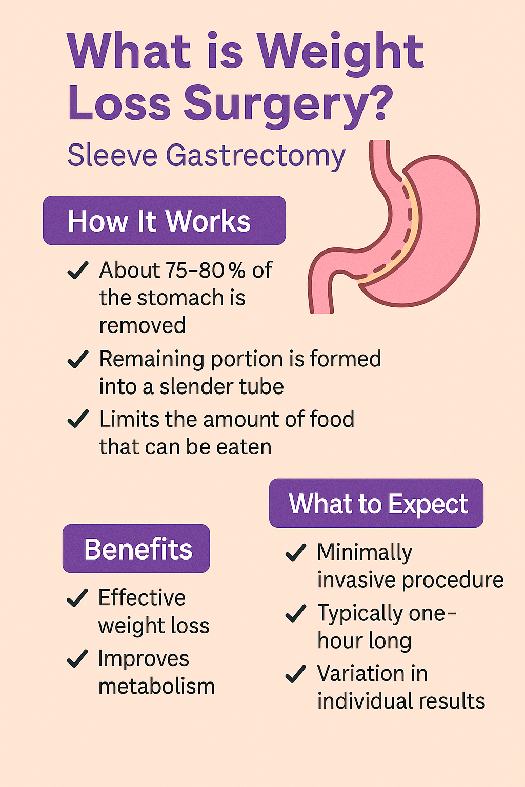 Sleeve Gastrectomy Diagram